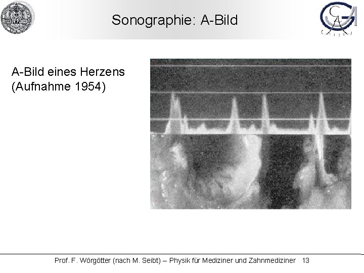 Sonographie: A-Bild eines Herzens (Aufnahme 1954) Prof. F. Wörgötter (nach M. Seibt) -- Physik