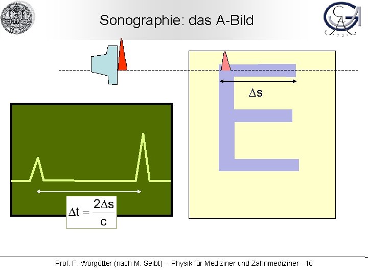Sonographie: das A-Bild Ds Prof. F. Wörgötter (nach M. Seibt) -- Physik für Mediziner