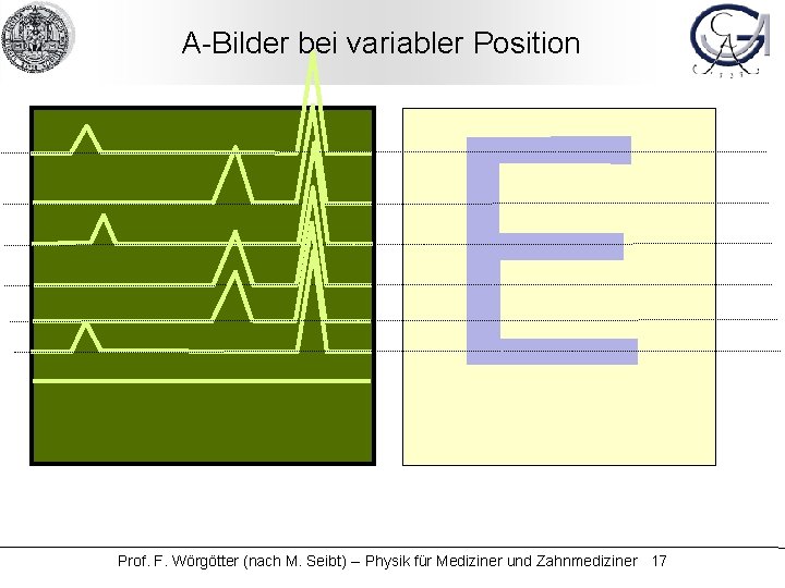 A-Bilder bei variabler Position Prof. F. Wörgötter (nach M. Seibt) -- Physik für Mediziner