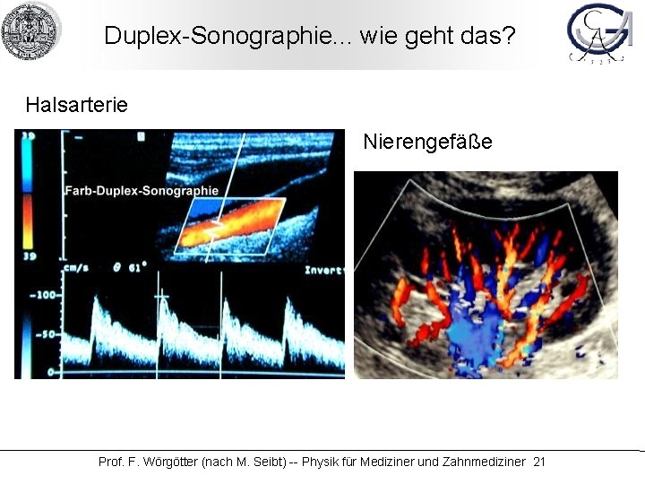 Duplex-Sonographie. . . wie geht das? Halsarterie Nierengefäße Prof. F. Wörgötter (nach M. Seibt)