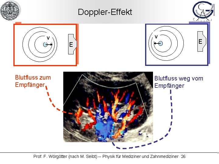 Doppler-Effekt v v E Blutfluss zum Empfänger E Blutfluss weg vom Empfänger Prof. F.