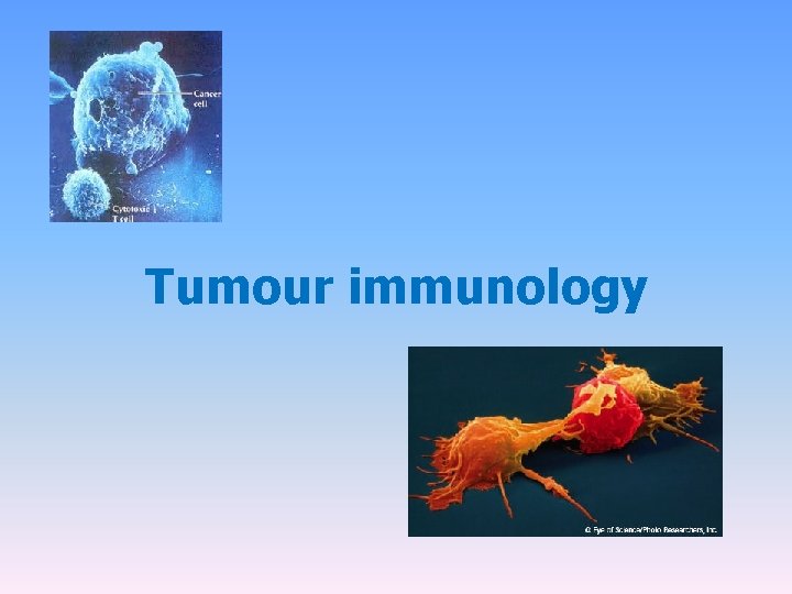 Tumour immunology 