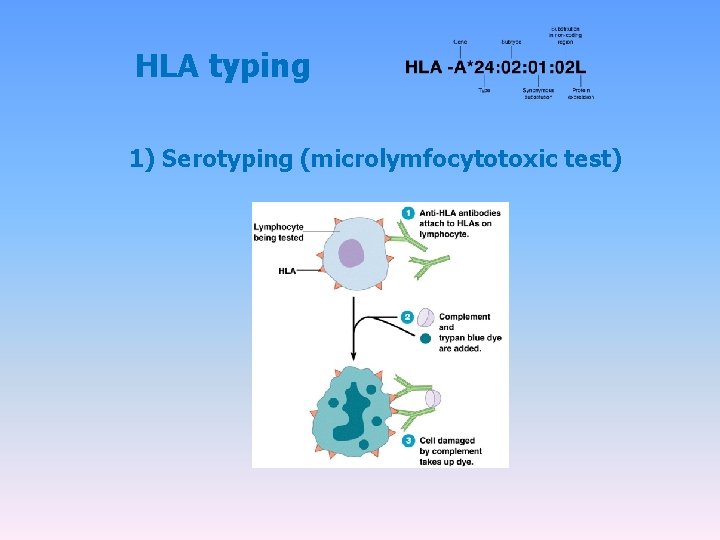 HLA typing 1) Serotyping (microlymfocytotoxic test) 