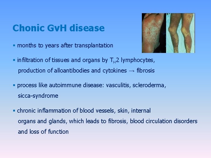 Chonic Gv. H disease § months to years after transplantation § infiltration of tissues