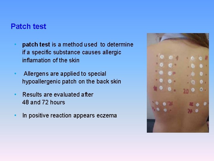 Patch test • patch test is a method used to determine if a specific