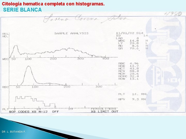 Citología hematica completa con histogramas. SERIE BLANCA DR. L. BUTANDA F. Citología hematica completa con histogramas. SERIE BLANCA DR. L. BUTANDA F.