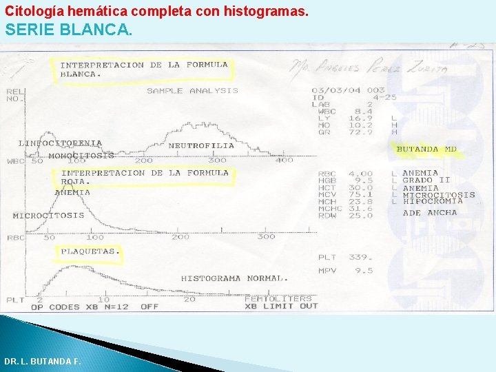 Citología hemática completa con histogramas. SERIE BLANCA. DR. L. BUTANDA F. Citología hemática completa con histogramas. SERIE BLANCA. DR. L. BUTANDA F.