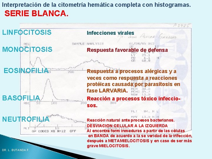 Interpretación de la citometría hemática completa con histogramas. SERIE BLANCA. LINFOCITOSIS Infecciones virales MONOCITOSIS Interpretación de la citometría hemática completa con histogramas. SERIE BLANCA. LINFOCITOSIS Infecciones virales MONOCITOSIS
