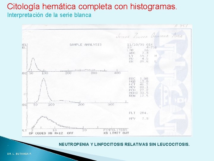 Citología hemática completa con histogramas. Interpretación de la serie blanca . DR. L. BUTANDA Citología hemática completa con histogramas. Interpretación de la serie blanca . DR. L. BUTANDA