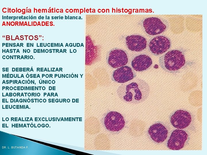 Citología hemática completa con histogramas. Interpretación de la serie blanca. ANORMALIDADES. “BLASTOS”: PENSAR EN Citología hemática completa con histogramas. Interpretación de la serie blanca. ANORMALIDADES. “BLASTOS”: PENSAR EN