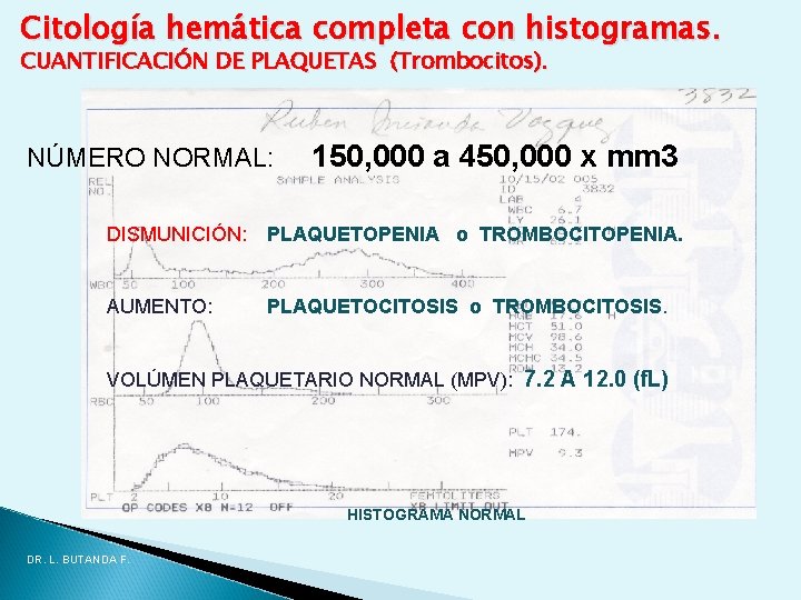Citología hemática completa con histogramas. CUANTIFICACIÓN DE PLAQUETAS (Trombocitos). NÚMERO NORMAL: 150, 000 a Citología hemática completa con histogramas. CUANTIFICACIÓN DE PLAQUETAS (Trombocitos). NÚMERO NORMAL: 150, 000 a