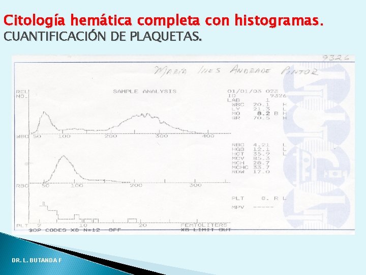 Citología hemática completa con histogramas. CUANTIFICACIÓN DE PLAQUETAS. DR. L. BUTANDA F Citología hemática completa con histogramas. CUANTIFICACIÓN DE PLAQUETAS. DR. L. BUTANDA F