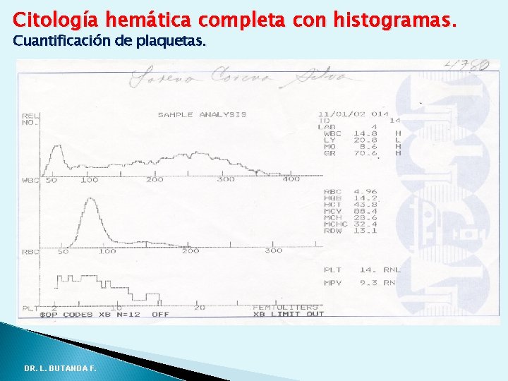 Citología hemática completa con histogramas. Cuantificación de plaquetas. DR. L. BUTANDA F. Citología hemática completa con histogramas. Cuantificación de plaquetas. DR. L. BUTANDA F.