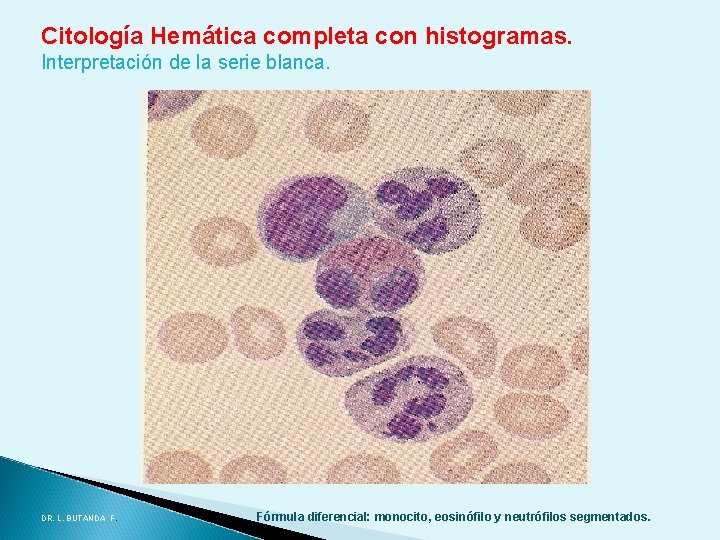 Citología Hemática completa con histogramas. Interpretación de la serie blanca. DR. L. BUTANDA F. Citología Hemática completa con histogramas. Interpretación de la serie blanca. DR. L. BUTANDA F.