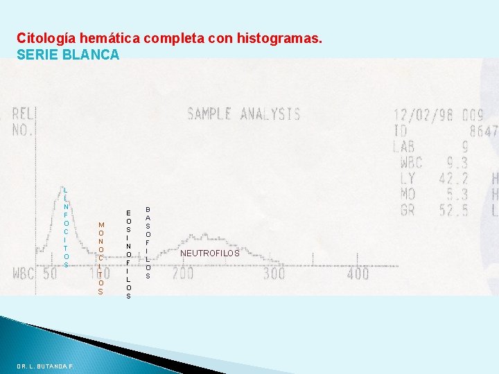 Citología hemática completa con histogramas. SERIE BLANCA L I N F O C I Citología hemática completa con histogramas. SERIE BLANCA L I N F O C I