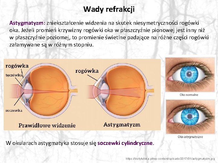 Wady refrakcji Astygmatyzm: zniekształcenie widzenia na skutek niesymetryczności rogówki oka. Jeżeli promień krzywizny rogówki
