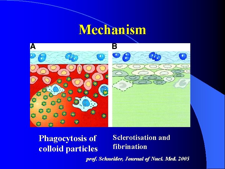Mechanism Phagocytosis of colloid particles Sclerotisation and fibrination prof. Schneider, Journal of Nucl. Med.