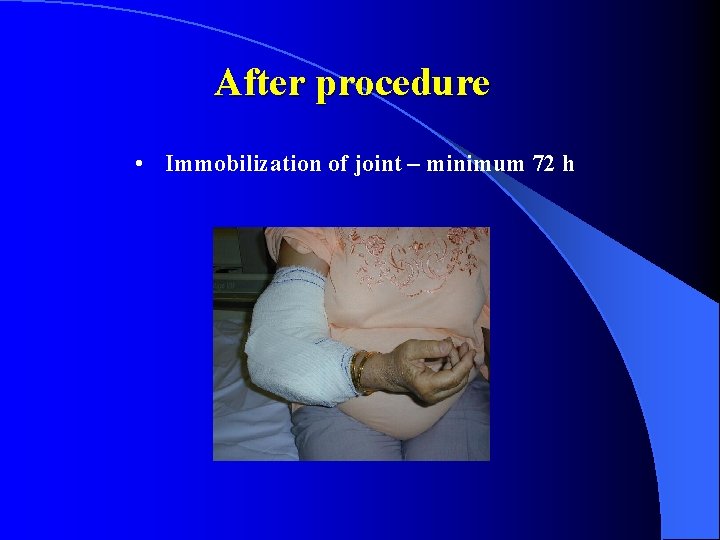 After procedure • Immobilization of joint – minimum 72 h 