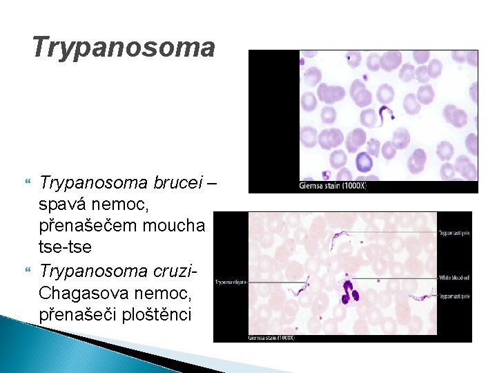 Trypanosoma brucei – spavá nemoc, přenašečem moucha tse-tse Trypanosoma cruzi- Chagasova nemoc, přenašeči ploštěnci