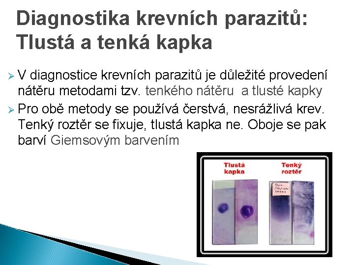 Diagnostika krevních parazitů: Tlustá a tenká kapka Ø V diagnostice krevních parazitů je důležité