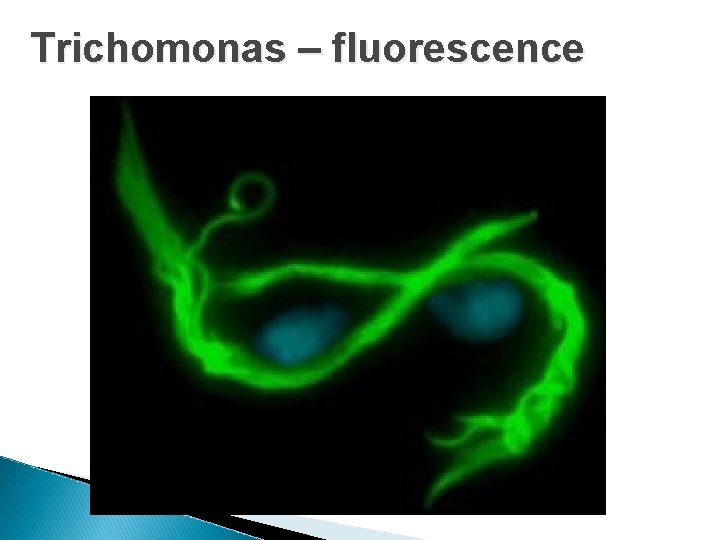 Trichomonas – fluorescence 