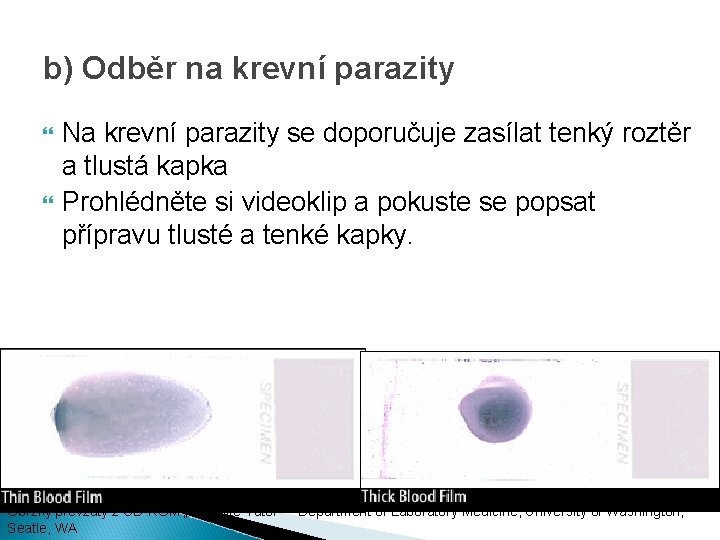 b) Odběr na krevní parazity Na krevní parazity se doporučuje zasílat tenký roztěr a