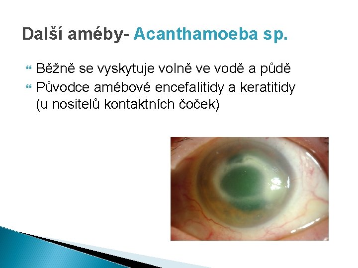 Další améby- Acanthamoeba sp. Běžně se vyskytuje volně ve vodě a půdě Původce amébové