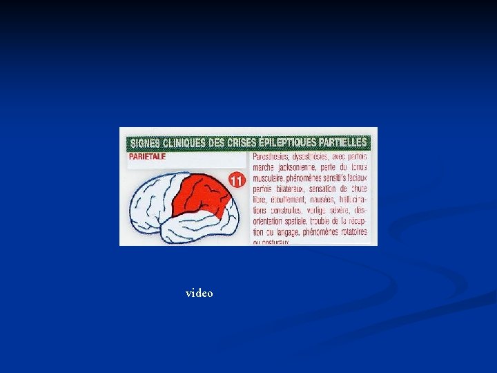 video 