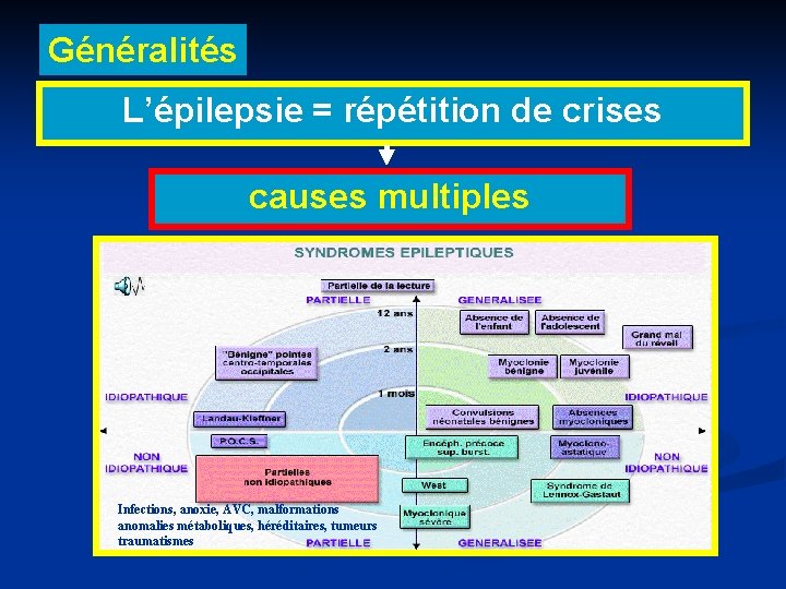 Généralités L’épilepsie = répétition de crises causes multiples Infections, anoxie, AVC, malformations anomalies métaboliques,
