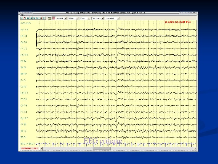 EEG critique 