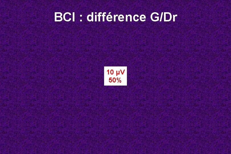 BCI : différence G/Dr 10 μV 50% 