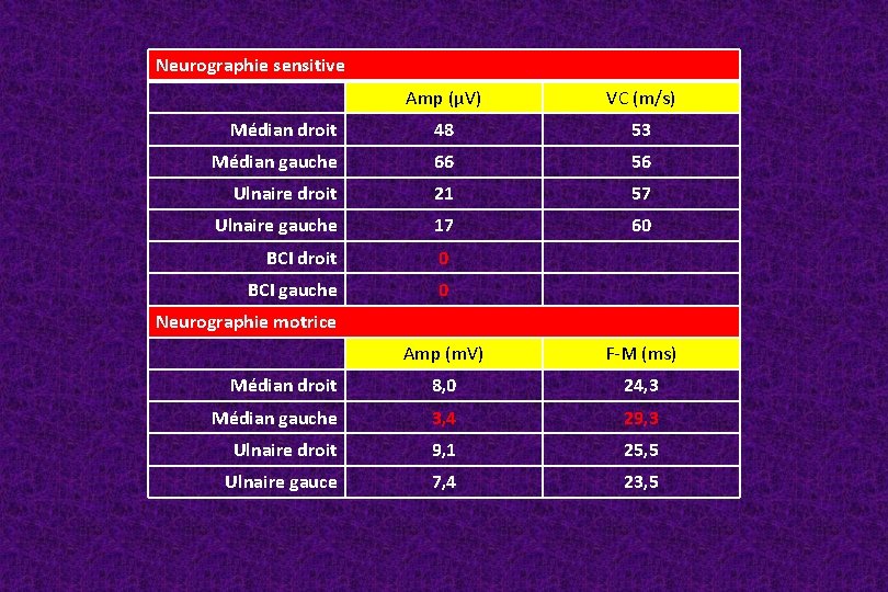 Neurographie sensitive Amp (μV) VC (m/s) Médian droit 48 53 Médian gauche 66 56