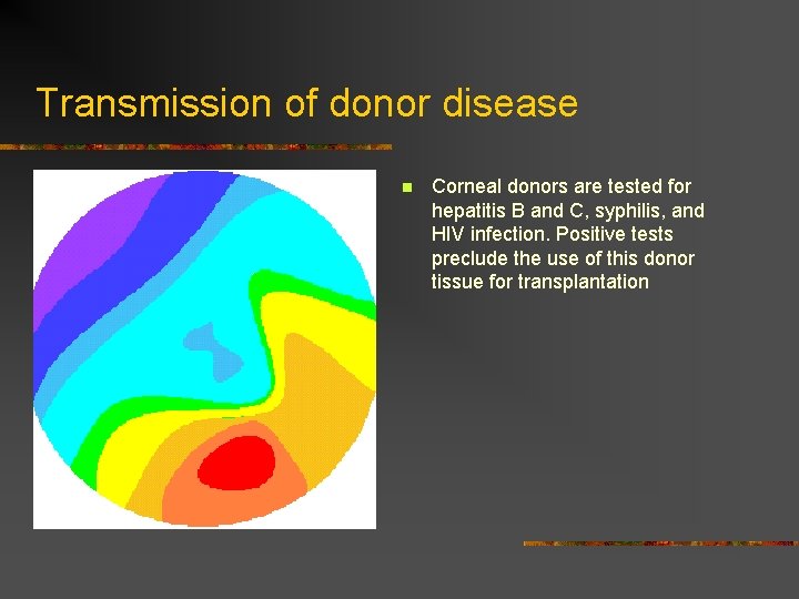 Transmission of donor disease n Corneal donors are tested for hepatitis B and C,