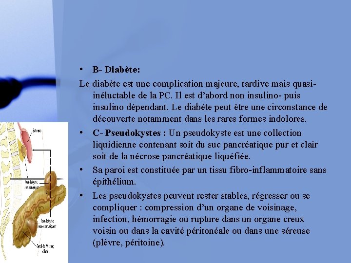  • B- Diabète: Le diabète est une complication majeure, tardive mais quasiinéluctable de