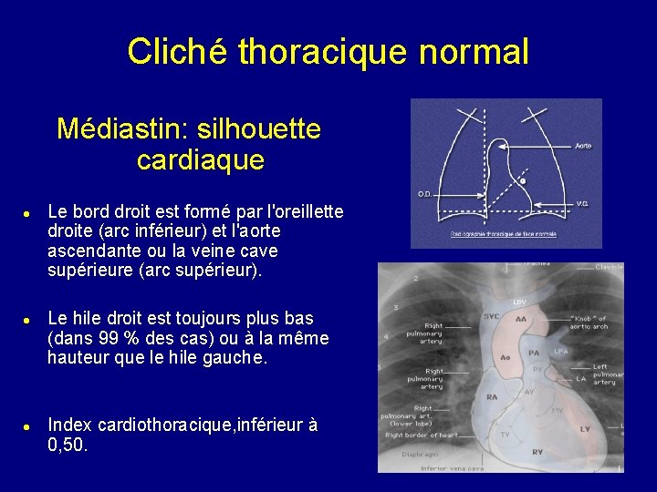 Cliché thoracique normal Médiastin: silhouette cardiaque Le bord droit est formé par l'oreillette droite