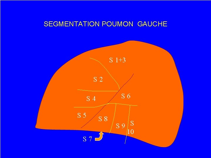 SEGMENTATION POUMON GAUCHE S 1+3 S 2 S 6 S 4 S 5 S