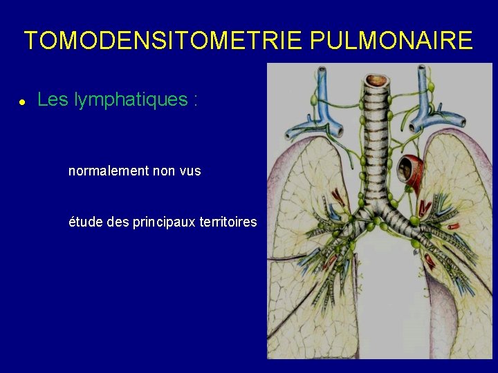 TOMODENSITOMETRIE PULMONAIRE Les lymphatiques : normalement non vus étude des principaux territoires 