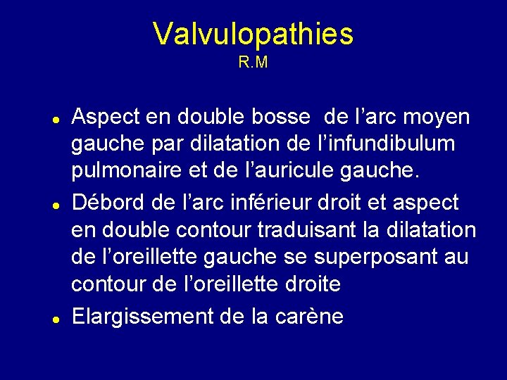 Valvulopathies R. M Aspect en double bosse de l’arc moyen gauche par dilatation de