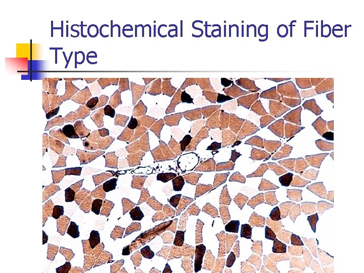 Histochemical Staining of Fiber Type 