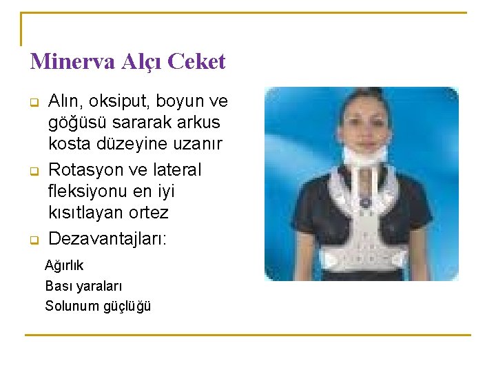 Minerva Alçı Ceket q q q Alın, oksiput, boyun ve göğüsü sararak arkus kosta Minerva Alçı Ceket q q q Alın, oksiput, boyun ve göğüsü sararak arkus kosta