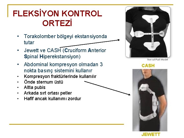 FLEKSİYON KONTROL ORTEZİ • Torakolomber bölgeyi ekstansiyonda tutar • Jewett ve CASH (Cruciform Anterior FLEKSİYON KONTROL ORTEZİ • Torakolomber bölgeyi ekstansiyonda tutar • Jewett ve CASH (Cruciform Anterior
