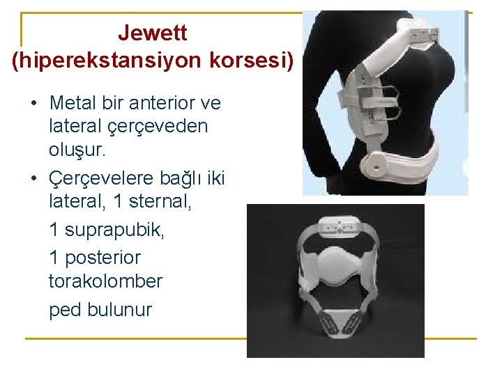 Jewett (hiperekstansiyon korsesi) • Metal bir anterior ve lateral çerçeveden oluşur. • Çerçevelere bağlı Jewett (hiperekstansiyon korsesi) • Metal bir anterior ve lateral çerçeveden oluşur. • Çerçevelere bağlı