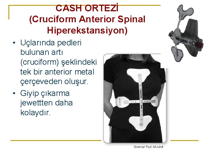 CASH ORTEZİ (Cruciform Anterior Spinal Hiperekstansiyon) • Uçlarında pedleri bulunan artı (cruciform) şeklindeki tek CASH ORTEZİ (Cruciform Anterior Spinal Hiperekstansiyon) • Uçlarında pedleri bulunan artı (cruciform) şeklindeki tek