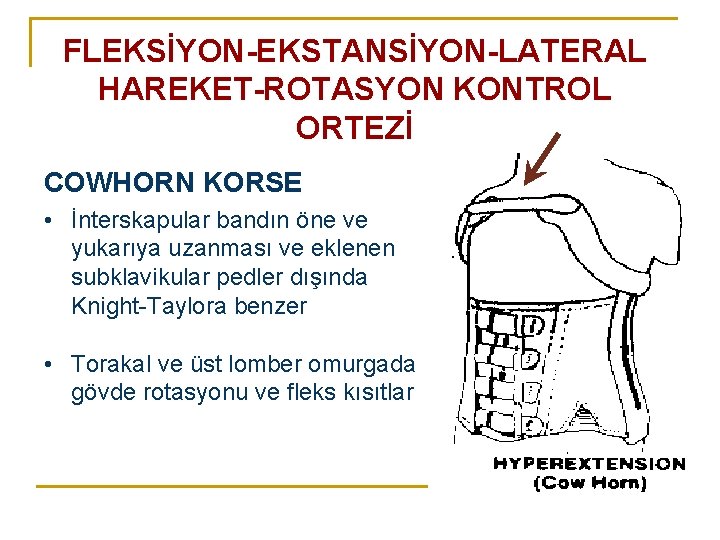 FLEKSİYON-EKSTANSİYON-LATERAL HAREKET-ROTASYON KONTROL ORTEZİ COWHORN KORSE • İnterskapular bandın öne ve yukarıya uzanması ve FLEKSİYON-EKSTANSİYON-LATERAL HAREKET-ROTASYON KONTROL ORTEZİ COWHORN KORSE • İnterskapular bandın öne ve yukarıya uzanması ve