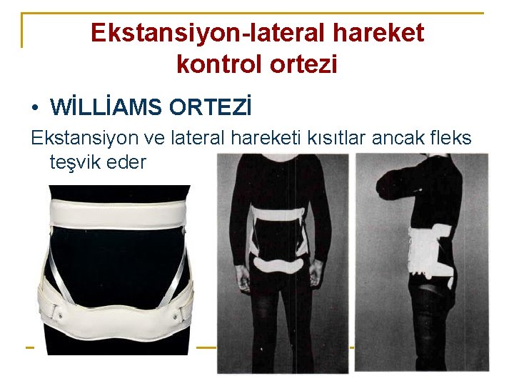 Ekstansiyon-lateral hareket kontrol ortezi • WİLLİAMS ORTEZİ Ekstansiyon ve lateral hareketi kısıtlar ancak fleks Ekstansiyon-lateral hareket kontrol ortezi • WİLLİAMS ORTEZİ Ekstansiyon ve lateral hareketi kısıtlar ancak fleks