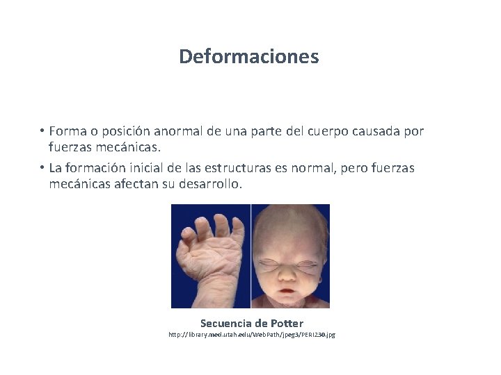 Deformaciones • Forma o posición anormal de una parte del cuerpo causada por fuerzas Deformaciones • Forma o posición anormal de una parte del cuerpo causada por fuerzas