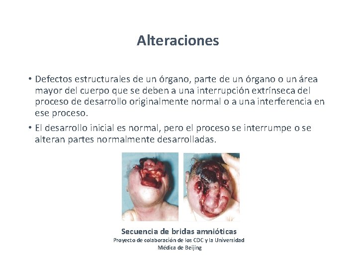 Alteraciones • Defectos estructurales de un órgano, parte de un órgano o un área Alteraciones • Defectos estructurales de un órgano, parte de un órgano o un área