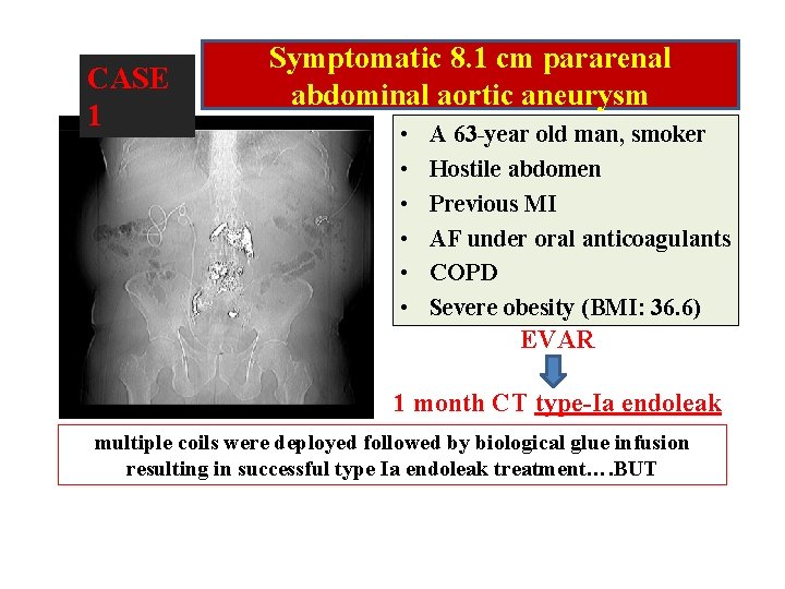 CASE 1 Symptomatic 8. 1 cm pararenal abdominal aortic aneurysm • • • A