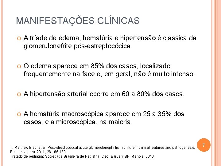 MANIFESTAÇÕES CLÍNICAS A tríade de edema, hematúria e hipertensão é clássica da glomerulonefrite pós-estreptocócica.