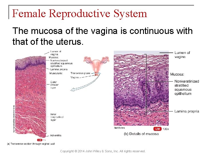 Female Reproductive System The mucosa of the vagina is continuous with that of the